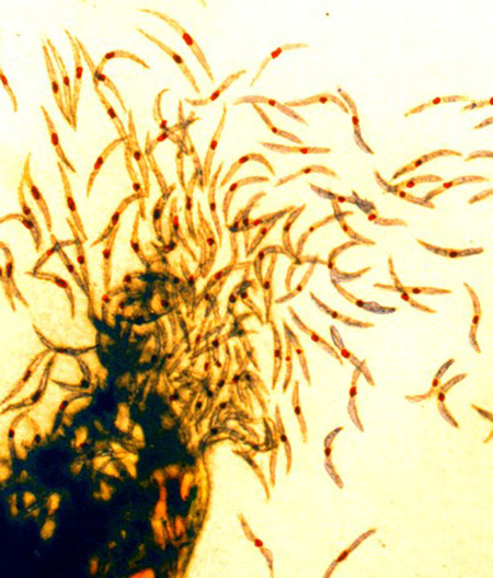 Malaria sporozoites. Photo credit: NIAID, WikiCommons 2015, CC-BY2.0.